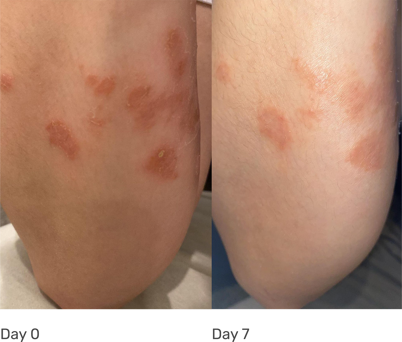 Transformative Results before