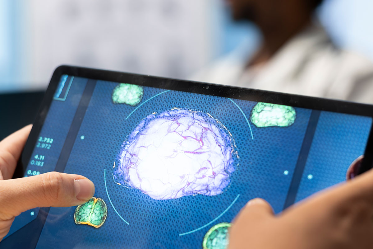 The Importance of Brain Health Screening - AvantHealth